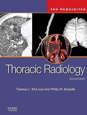 Thoracic Radiology: the Requisites