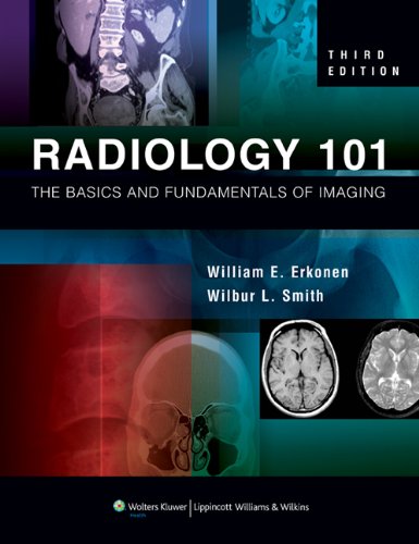 Radiology 101 : The Basics and Fundamentals of Imaging used book by ...