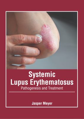 Sle Rash Textbook Systemic Lupus Erythematosus: Pathogenesis and Treatment book by Jasper ...