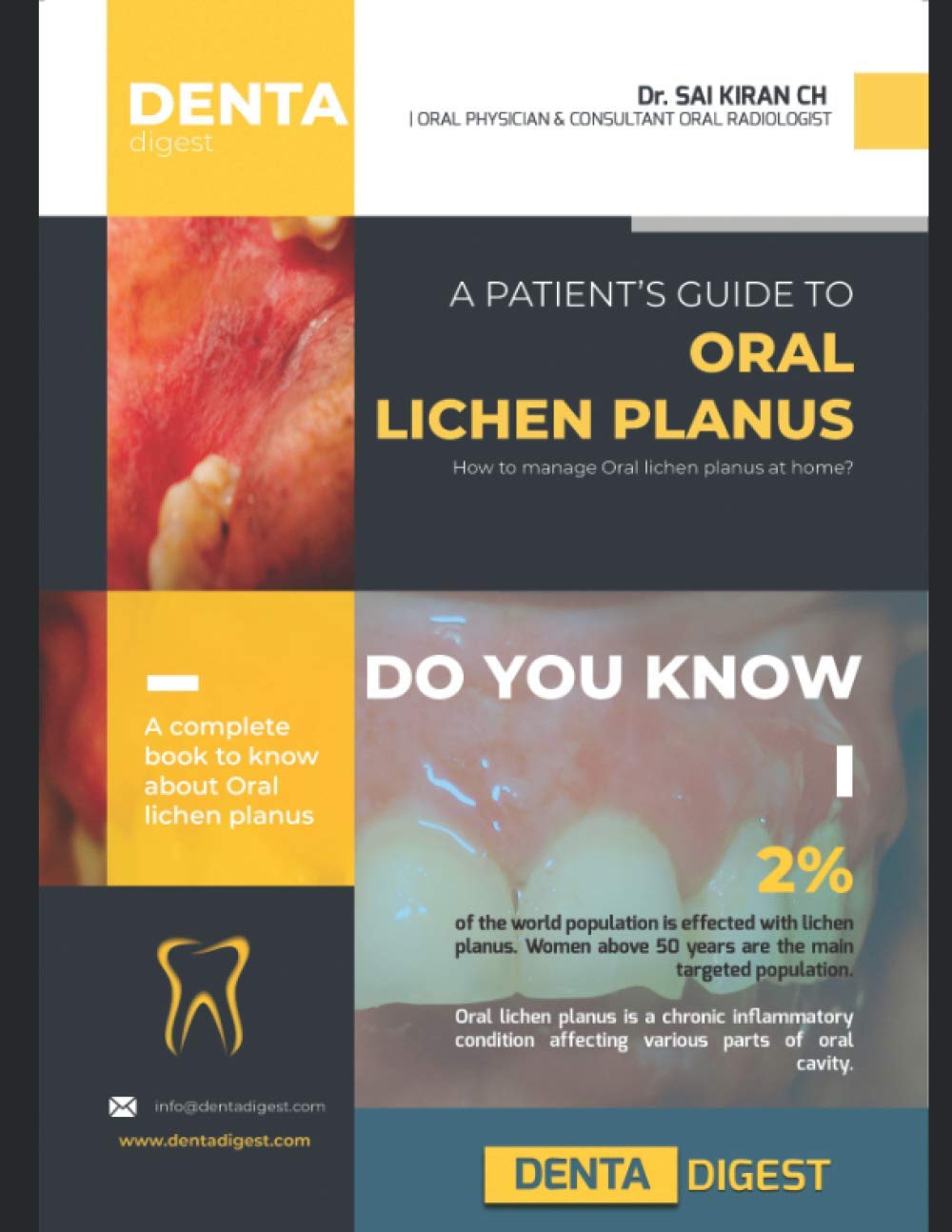 A patient's guide to Oral Lichen Planus book 9798592142802