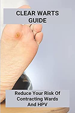 Clear Warts Guide: Reduce Your Risk Of Contracting Wards And Hpv: Does