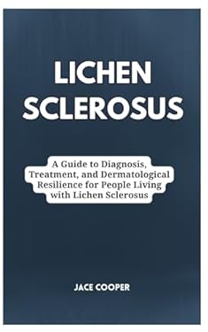 Sle Rash Textbook LICHEN SCLEROSUS: A Guide to Diagnosis, Treatment, and Dermatological ...