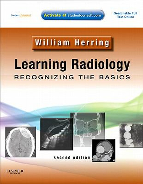 Learning Radillogy LEARNING RADIOLOGY : Recognizing the Basics with STUDENT CONSULT £4.90 ...